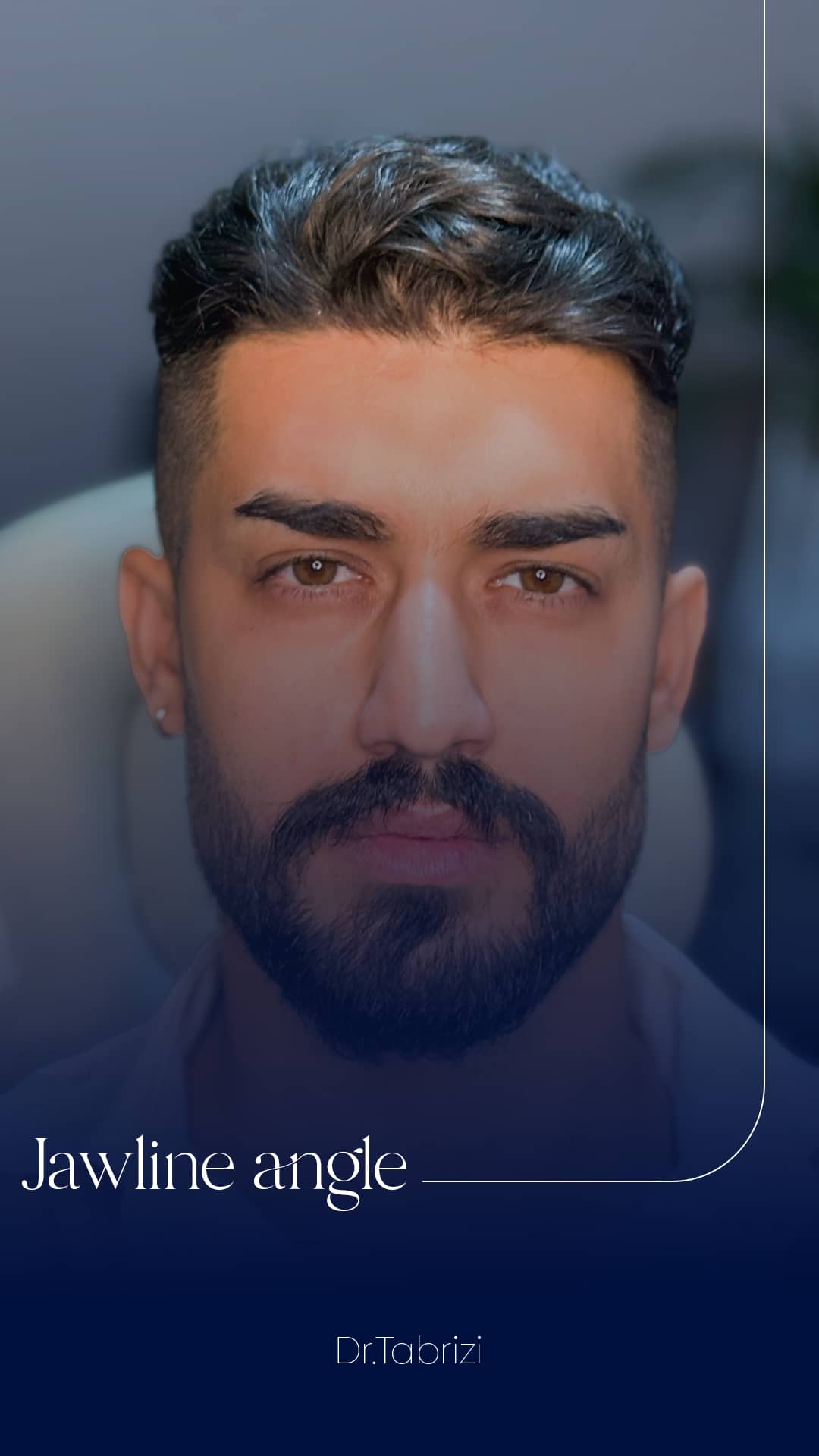 slider__image