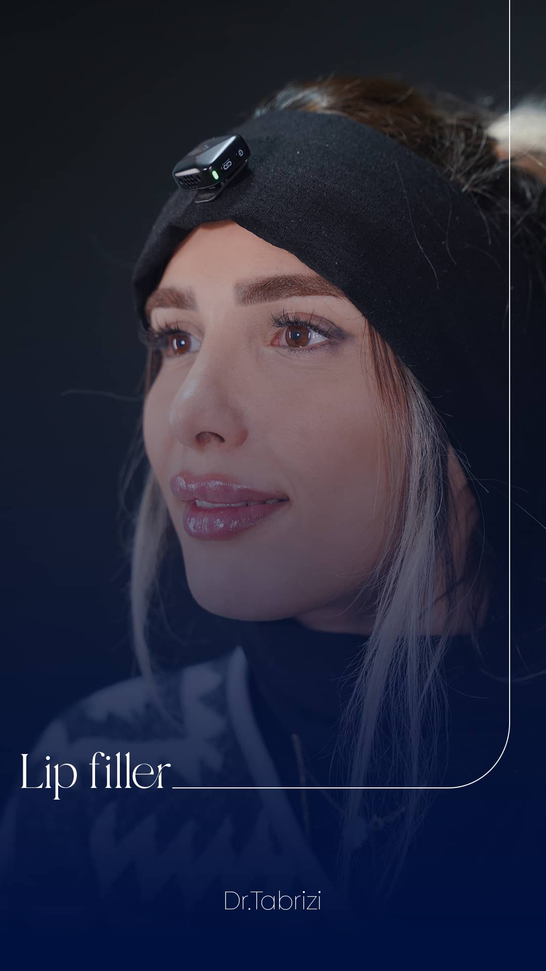slider__image